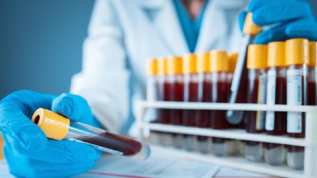 Simak! Inilah Golongan Darah Paling Langka Di Dunia