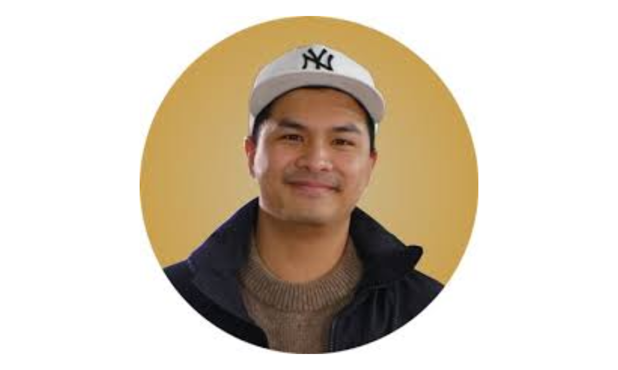 Glenn Alinskie Menderita Hipertrofi Konka, Kenali Penyebab dan Gejalanya