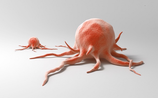 Bahaya Kanker yang Sering Diabaikan oleh Banyak Orang